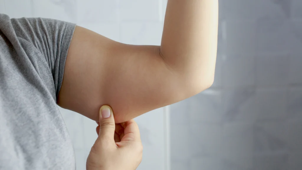 cellulite bras